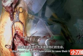 BBC手术室故事纪录片《外科医生：生命边缘 Surgeons: At the Edge of Life 2023》第5季全6集 英语中英双字 官方纯净版 1080P/MKV/8.64G百度网盘下载